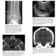 Illustration for article titled Researchers Study How X-Rays Can Be a Flag for Domestic Violence